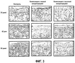 Композиции, пригодные для лечения кожных признаков старения (патент 2409290)
