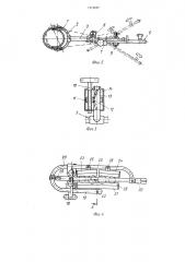 Аппарат для репозиции переломов костей предплечья (патент 1215687)