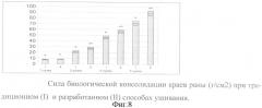 Способ ушивания лапаротомной раны (патент 2314049)