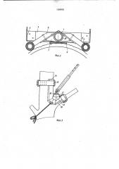 Устройство для подъема на деревья (патент 1020052)