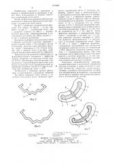 Внутрикостный фиксатор (патент 1215685)