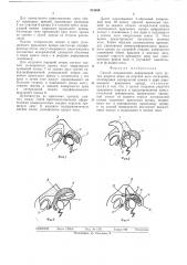 Способ исправления деформаций носа (патент 513689)