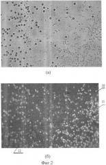 Способ лазерного фототермолиза серповидно-клеточных эритроцитов (патент 2345805)