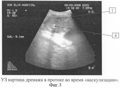 Способ интраоперационной диагностики патологии желчевыводящих протоков при лапароскопических операциях (патент 2310386)