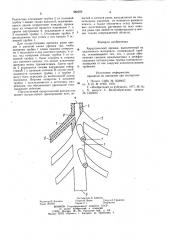 Хирургический дренаж (патент 988292)