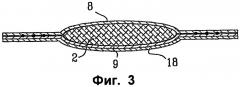 Поглощающее изделие, содержащее эластичный многослойный материал (патент 2414203)