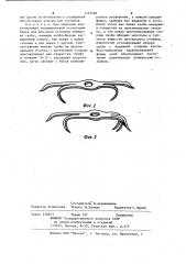 Скоба для остеосинтеза (патент 1152582)