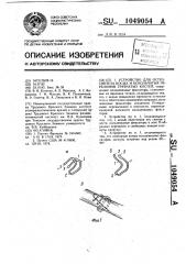 Устройство для остеосинтеза косых и оскольчатых переломов трубчатых костей (патент 1049054)