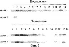 Способ определения вероятности терапевтического ответа на противораковую химиотерапию сердечным гликозидом (патент 2508114)