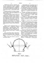 Медицинская банка г.ф.антоненко (патент 1093344)