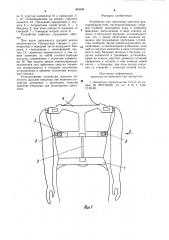 Устройство для крепления протезов рук (патент 982686)