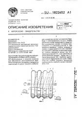 Устройство для разделения корнеплодов и примесей по длине (патент 1822652)