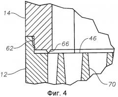 Хирургическая кассета с улучшенной очисткой воздуха (патент 2432184)