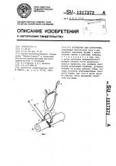 Устройство для остеотомии (патент 1217372)