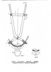 Устройство для проведения спиц (патент 839513)