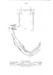 Устройство ю.м.тараева для лечения переломов челюсти (патент 860757)