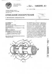 Способ формирования клапана тонкой кишки (патент 1680090)