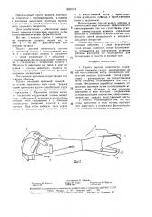 Протез верхней конечности (патент 1553113)