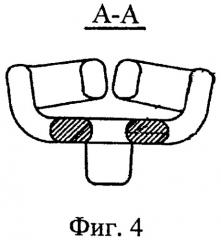 Устройство для фиксации и способ комбинированного переднего и заднего атлантоаксиального спондилодеза при переломовывихах c1-c2 позвонков (патент 2401079)