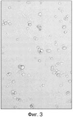 Способ культивирования стволовых клеток, препятствующий их спонтанной дифференцировке (варианты) (патент 2563347)