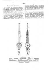 Устройство для измерения внутричерепногодавления (патент 296559)
