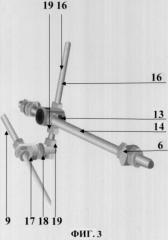 Способ чрескостного остеосинтеза переломовывихов костей предплечья типа монтеджа и аппарат для его осуществления (патент 2324448)
