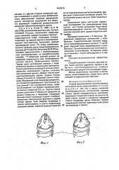 Способ формирования трахеопищеводного шунта после ларингэктомии (патент 1819576)