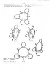 Способ изготовления держателя искусственного хрусталика (патент 1039451)