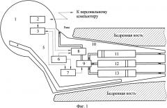 Спейсер тазобедренного сустава (патент 2663628)