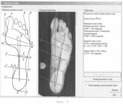 Способ диагностики состояния отделов стопы (патент 2253363)