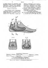 Искусственная стопа (патент 806023)