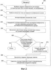 Интерактивный итеративный алгоритм ближайших точек для сегментации органов (патент 2540829)