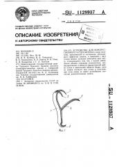 Устройство для компрессионного остеосинтеза (патент 1128937)