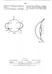 Искусственный хрусталик глаза (патент 332830)