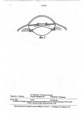 Искусственный хрусталик глаза для имплантации в факичный глаз (патент 1715341)