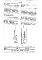 Устройство для контроля технического состояния закрытых полостей (патент 1561060)