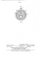 Внутриаортальный баллон-насос для вспомогательного кровообращения (патент 1186216)