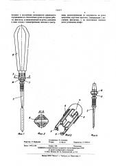 Устройство для обработки костной ткани (патент 511077)