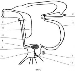 Способ операции при атрезии наружного слухового прохода (патент 2426500)