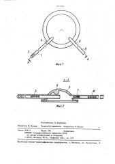 Имплантируемый шунт для лечения гидроцефалии (патент 1297870)