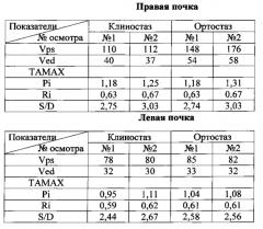 Способ ультразвуковой допплерографии при нефроптозе (патент 2571892)