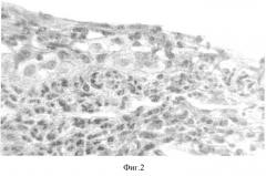 Способ моделирования грибкового кератита у кроликов (патент 2346338)