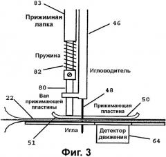 Способ и устройство для сшивания (патент 2335586)