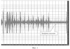 Способ фильтрации дыхательных шумов на основе задержки дыхания (патент 2415643)