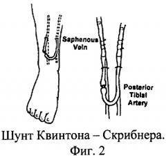 Способ 