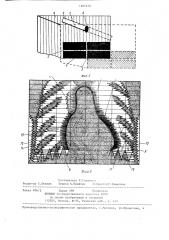 Рентгенокимографический растр (патент 1294340)