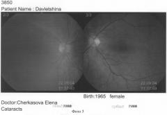 Способ диагностики начальной оптически значимой катаракты (патент 2310370)