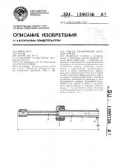 Способ пункционной биопсии печени (патент 1389756)