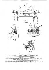 Устройство для обзора операционного поля в полости рта (патент 1524870)