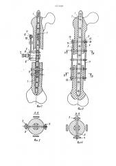 Устройство для фиксации фрагментов трубчатых костей (патент 1271499)